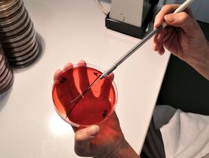 Rozočkovávání mikrobiologickou kličkou